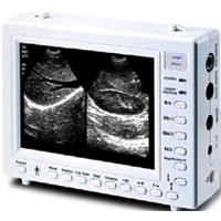 Palmtop Mechanic Ultrasound Scanner