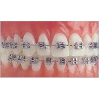 Dental, Orthodontics, Brackets,Buccal Tubes,