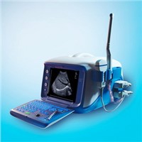 CX9000C Portable Ultrasound Scanner