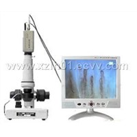 Portable Color LCD Microcirculation Microscope