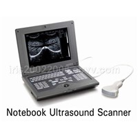 Note Book Ultrasound Scanner