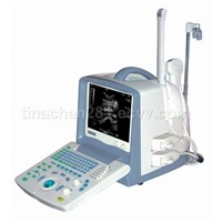 Full Digital Portable Ultrasound Scanner -BW8S