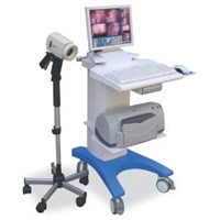 High quality Electronic Colposcope