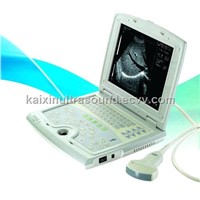 Full-digital Laptop Ultrasound Scanner (KX5000)