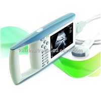 Full-digital Palm Ultrasound Scanner (KX5100)