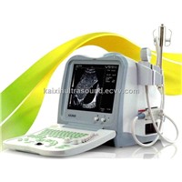 Full-digital Portable Ultrasound Scanner (KX2600)