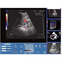 Software Of Ultrasound Image Station