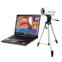 Digital Electronic Vaginoscope (DM601)