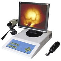 Infrared Mammary Diagnostic Apparatus