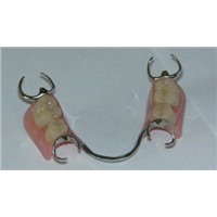 Removable denture /RPD