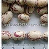 Light Speckled Kidney Beans - Round Shape