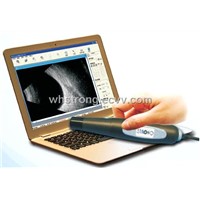 B-Scan Ophthalmic Ultrasound