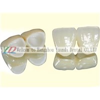 Cercon Zirconia false teeth or tooth/dental/denture/PFM crown