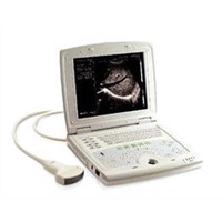 Full Digital Veterinary Laptop Ultrasound Scanner-RSD-RD8(HUMAN)