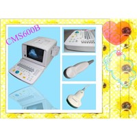 600B New Portable B-Ultrasound Scanner (CMS600B)