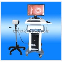 Electric colposcope equipment