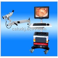 Electric colposcope equipment