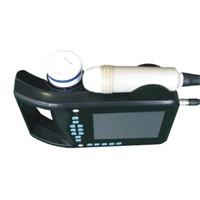 SS-1 Palm Handle Ultrasound B Scanner