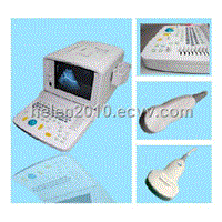 B-Ultrasound Scanner (CMS600B )