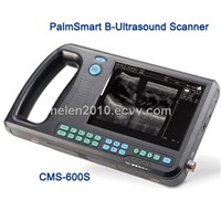 Digital Palmsmart Ultrasound Scanner CMS600s (CE Approved)