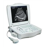 Full Digital Laptop Ultrasound Scanner-RSD-RP6A Plus(HUMAN)