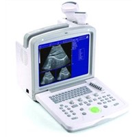 Full Digital Ultrasound Scanner