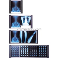 LED Slim X-Ray Medical Film Viewer (1-4 Films)