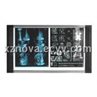 Double Films LED X-Ray Viewer (N-5002)