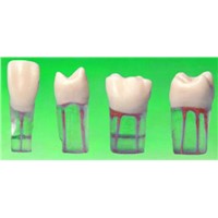 Root Canal Model s12