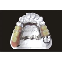 Dental Denture