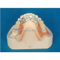 Dental Tooth coloured Framework Duracetal Partial Denture