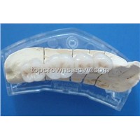 Dental supplier for Porcelain fused non precious metal crown