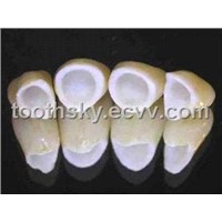 Dental All Ceramic Tooth - IPS e. Max CAD