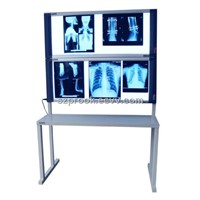 Medical Film Viewer with stand