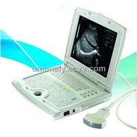 Digital Laptop Ultrasound Scanner Device (BW500)