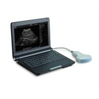 SW1000 Bmode ultrasonic diagnostic instrument