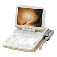 SW3000 Infrared Inspection Equipment for Mammary Gland