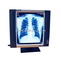 X-Ray Film Viewer with New Stand