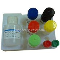 HIV Elisa Kit