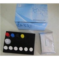 Human anti-insulin receptor antibody (AIRA) ELISA Kit