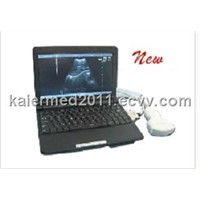 laptop ultrasound scanner