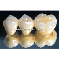 Dental Fixed Restoration PFM Crown