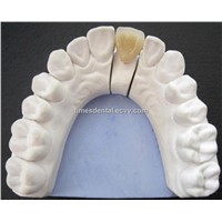 Dental PFM Porcelain Fused to Metal Crown/Ceramic Crown, Dental Fixed Restoration Porcelain Crown