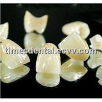 Dental Restoration e.max crown, full ceramic restoration empress crown