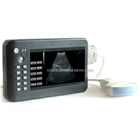 CX6000A  Hand carried Digital Diagnostic Ultrasound System for Human and Veterinary use