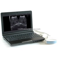 CX6000D   Notebook Digital Diagnostic Ultrasound System for Human and Veterinary use