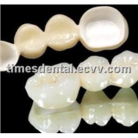 dental fixe restoration zirconium crown/bridge,dental cercon crown/bridge, full ceramic crown/bridge