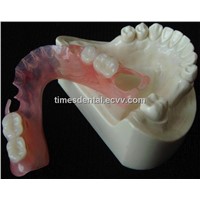 valplast denture,dental removable prosthesis flexible denture