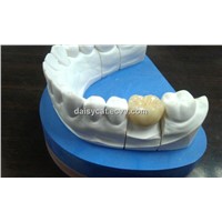 Zirconia crown