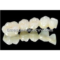 Dental All Ceramic Zirconium Crowns and Bridges Suplies